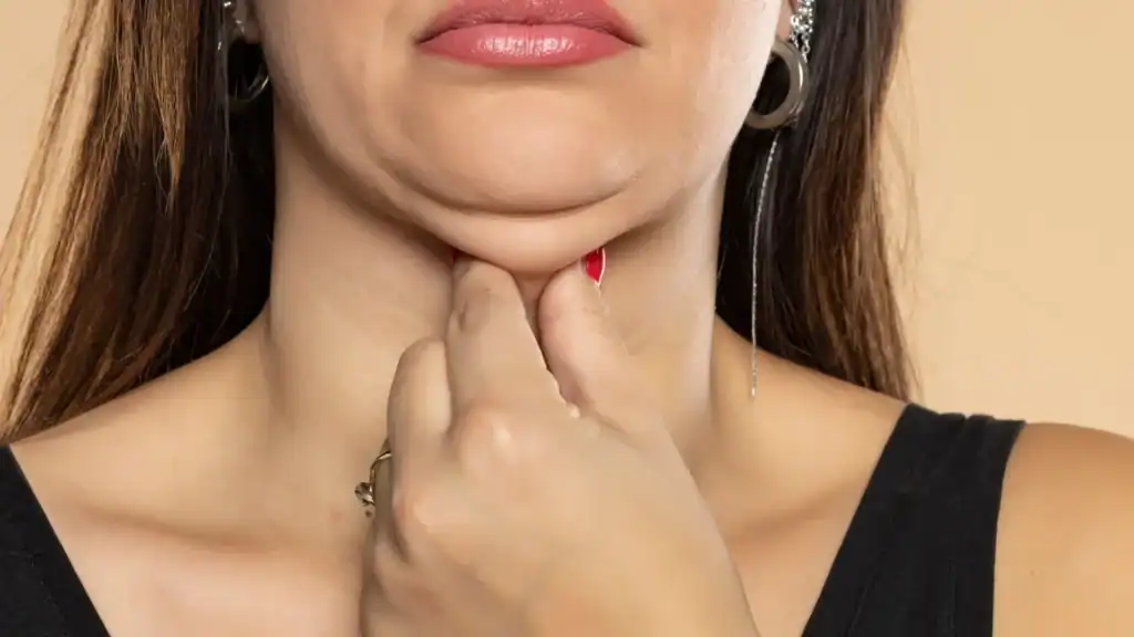 An image of a woman with double chin, sad, worried : Non Surgical Double Chin Removal Treatment in Huddersfield, UK