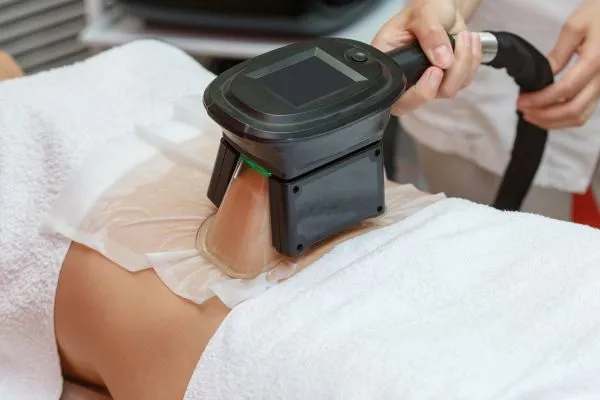 Image of person having fat freezing treatment to help weight gain Huddersfield