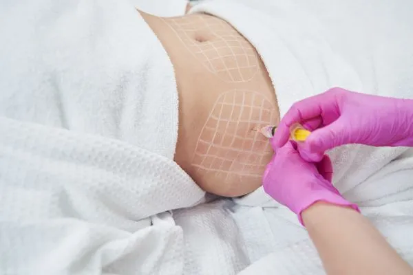 image of fat dissolving injections on love handles to help combat weight gain Huddersfield