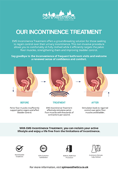image of how urge incontinence Huddersfield treatment works