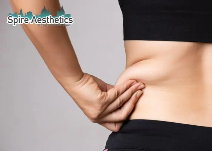 Image of woman pinching fat on their hips Huddersfield. Fat Freezing treatment